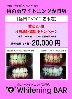 歯のホワイトニング月額通い放題キャンペーン